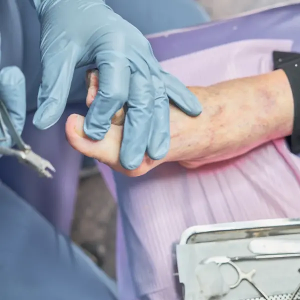podoactiva Caso de podología geriátrica: profesional tratando pie de anciano